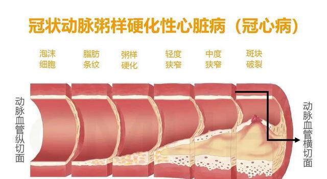脑供血不足，身体或出现6个症状，老人如何预防？7个建议听一听